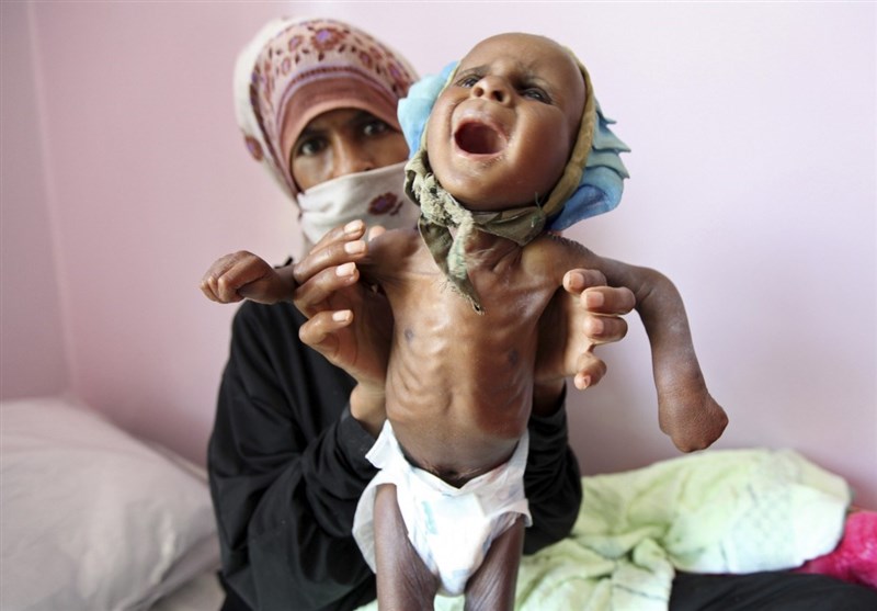 UN Agency Says Famine in Yemen Endangering 2 Million Mothers