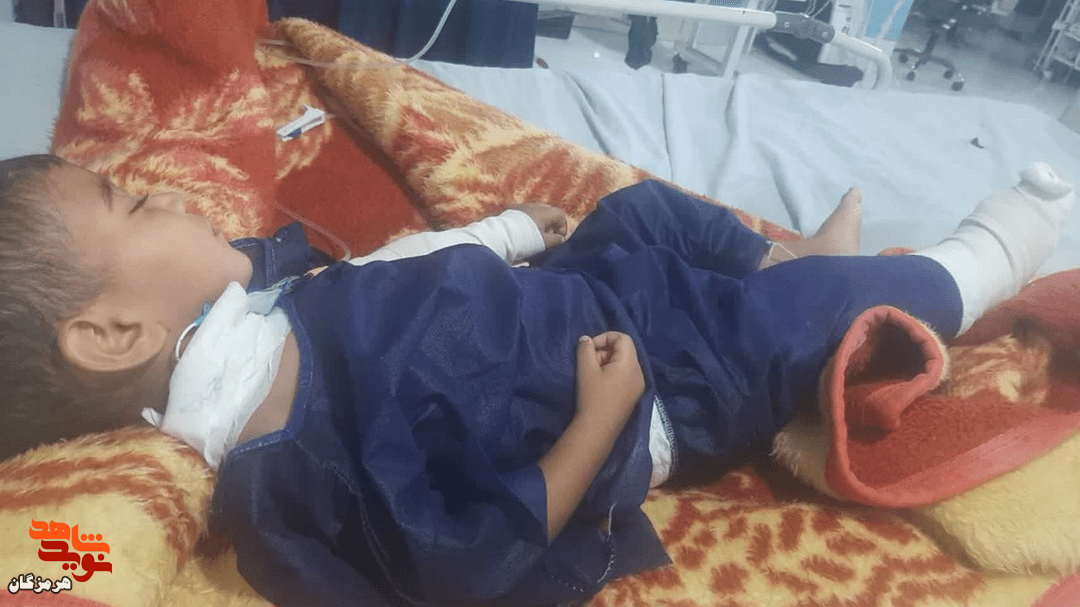 ترکش حمله آمریکا در قلب کودک یکساله بندرعباسی؛ مادر شهید شد ترکش حمله آمریکا در قلب کودک یکساله بندرعباسی؛ مادر شهید شد